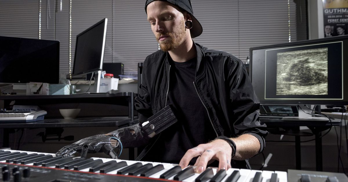 Cyborg strums 'Necessary particular person Wars' theme song with bionic ...