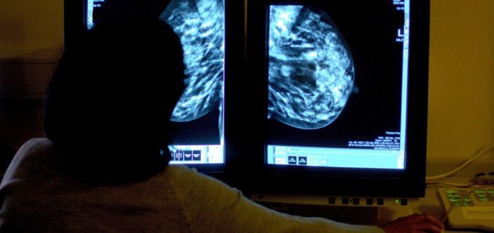 Breast cancer call handlers ‘given simply one hour’s practicing’