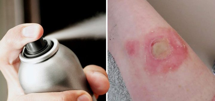 Why you mustn’t contain phase in the deodorant scenario